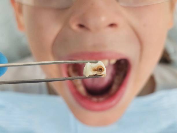 Best Pediatric Emergency Dentist in Tylertown, MS